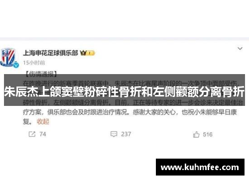 朱辰杰上颌窦壁粉碎性骨折和左侧颧额分离骨折